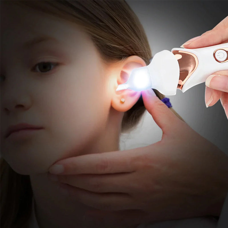 5-in-1 Electric Earwax Cleaner